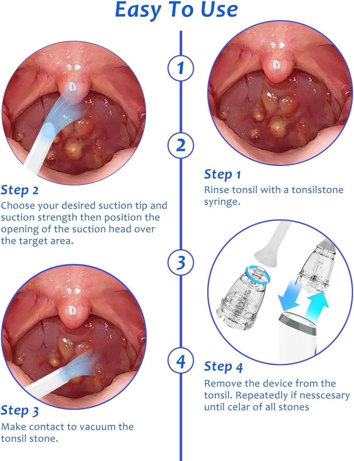 8 Suction Modes 3 Levels Tonsi - Gadgets For Electronics 评论和价格